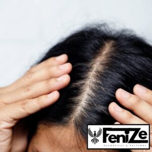L'Oréal Scalp Advanced: Solución Profesional para un Cuero Cabelludo Saludable L'Oréal Scalp Advanced: Champú profesional para tratar caspa, grasa y sensibilidad en el cuero cabelludo. Fórmula con niacinamida, ácido cítrico y piroctona olamina.